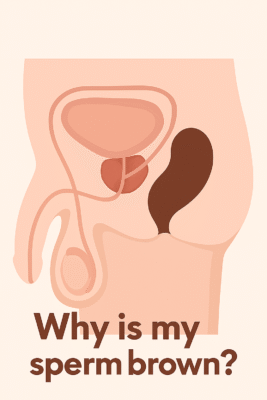 Why is my sperm brown?